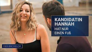 Kandidatin Hannah hat nur einen Fuß | Der Bachelor - Folge 02