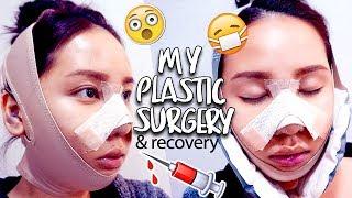 MY PLASTIC SURGERY IN KOREA | V-Line & Rhinoplasty Surgery & Recovery