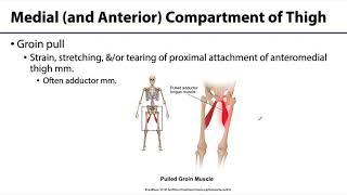 403 Lower Limb: Muscles of Thigh