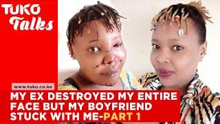 My ex destroyed my face, said no other man will ever have me PART 1 | Tuko Talks