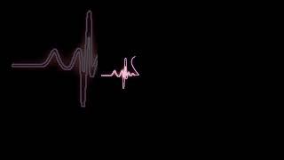 Heart   | Black Screen Video Heart Beat Line Effect | #love #blackscreenstatus