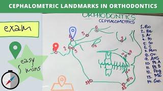 cephalometric landmarks in orthodontics