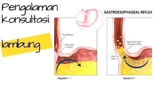 PENGALAMAN BEROBAT SAKIT GERD | LAMBUNG | GASTROHEPATOLOGI | RS PONDOK INDAH PART 1. #curhAYt Eps. 1