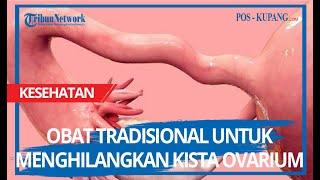 Obat Tradisional Untuk Menghilangkan Kista Ovarium