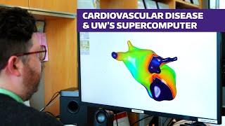 Cardiovascular Disease and UW's Supercomputer