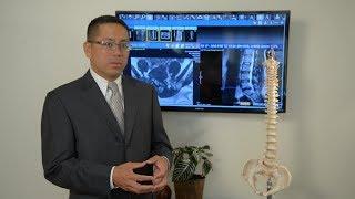 What is a Herniated Disc? Symptoms & Treatment Options Explained by Dr. Rey Bosita