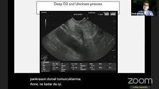 Day 1 - EUS Scopes, Stations of EUS Exams/Normal Anatomy Examples of Various Pathologies