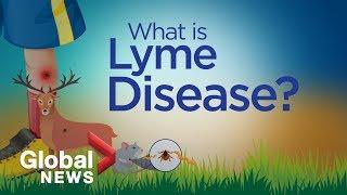 Why Lyme disease is on the rise, explained