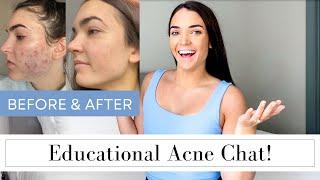 What I Want You To Know About Acne || Holistic Approach