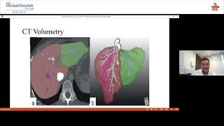 Liver Transplant in India | Manipal Health Diaries | Manipal Hospitals Delhi