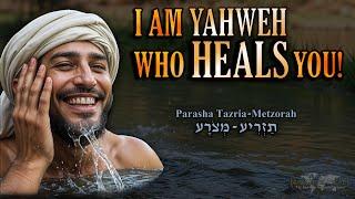 Parasha Tazria Metzorah 5784 (2024) - I Am Yahweh Who Heals You!