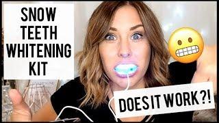 At Home Snow Teeth Whitening REVIEW! Unboxing & Sensitivity Test! DOES IT WORK?! | xameliax AD