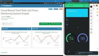 Cloud Based Multi-platform Pulse and Blood Oxygen Monitoring System