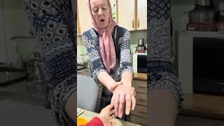 Kako je Nanina slomljena ruka | Update on Nana's broken hand