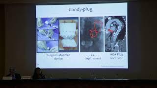 48.  Knickerboker and Candy plug techniques by Dr Enrico Rinaldi
