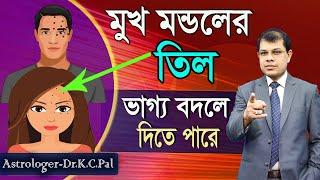 মুখ মন্ডলের তিল ভাগ্য বদলে দিতে পারে।Sesame seeds in the mouth can change the fate,Dr.K.C.Pal