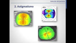 Que Necesito Saber Para Hacer Ortoqueratologia