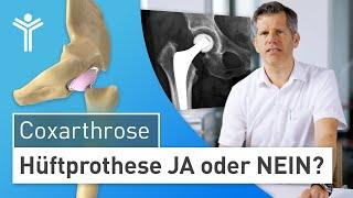 Künstliche Hüfte: TEP bei Hüftarthrose sinnvoll? | Hüftprothese