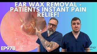EAR WAX REMOVAL - PATIENTS INSTANT PAIN RELIEF - EP978