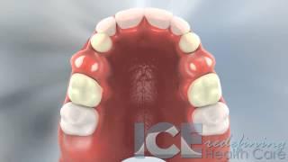 Dental Development (Upper Occlusal View)