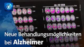 Alzheimer-Medikament vor Zulassung in der EU