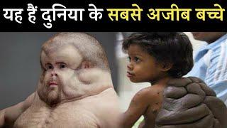 Unbelievable Kids | Amazing Facts Children xnxx | दुनिया के अजीब बच्चे | Mysterious Human