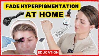 Fade Hyperpigmentation at Home (Results in 1 Month) | 2024