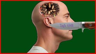 bald man  had treatment animation| ASMR remove maggots from had |ASMR2D treatment animation`