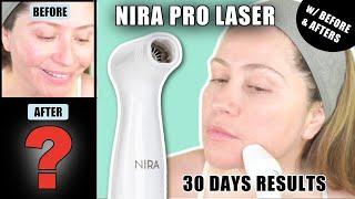 NIRA PRO LASER | 30 DAYS RESULTS | BEFORE & AFTERS + TIPS FOR BETTER RESULTS