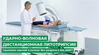 Ударно-волновая дистанционная литотрипсия. Удаление камней в почках без разреза в МЦ МИРТ