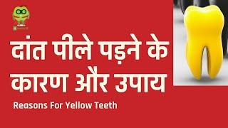 दांत पीले पड़ने के कारण और उपाय | Causes of yellow teeth and solutions | Healthyho