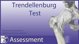 Trendelenburg Test | Hip Abductor Weakness