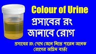 colour of urine | প্রসাবের রং জানাবে রোগ | b2unews | bangla health tips