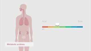 Understanding the acid-base balance – Radiometer