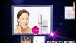 www.evenbetterasone.com | Neova Skin Care and Tricomin Hair Care | Radiancy and Photomedex Merger