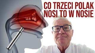 Prof. Dariusz Jurkiewicz o problemach związanych z leczeniem przewlekłego zapalenia zatok z polipami