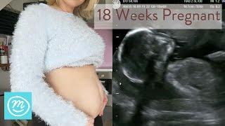 18 Weeks Pregnant: What You Need To Know - Channel Mum