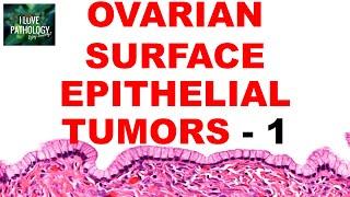 OVARIAN TUMORS -  Part 2 : SEROUS AND MUCINOUS TUMORS- Etiopathogenesis and morphology