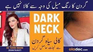 Gardan Ko Gora Karne Ka Tarika - Black Neck Whitening In Urdu - Neck Ka Kalapan Kaise Door Karens