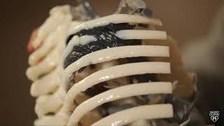 Mayo Clinic Minute: How 3D printing helps lung surgery