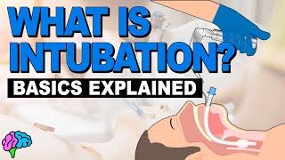 What is Intubation? - The Basics Explained