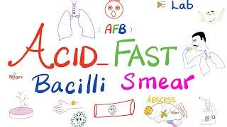 Acid Fast Bacilli Smear (AFB smear) for tuberculosis (TB) | Labs 