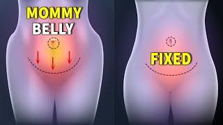 FIX MOMMY BELLY - 3 WEEKS | DO THIS EVERYDAY