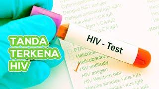 Waspada ! Ini Tanda-Tanda Kamu Terkena HIV !