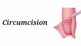 Circumcision surgery