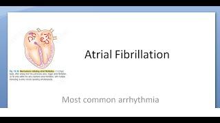 Medicine 491 Atrial Fibrillation Arrhythmia Stroke cause Heart Lone cause ecg RACE rivaROXIBAN