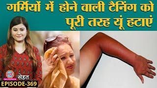 Summer में Skin हो जाती है Tan,Tanning से छुटकारा पाने के लिए क्या करें? | Sehat ep 369