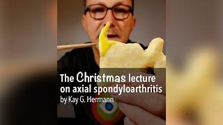 The Christmas lecture on axial spondyloarthritis – by Kay G. Hermann