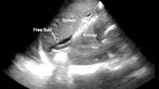 Focused Assessment With Sonography for Trauma (FAST) Examination