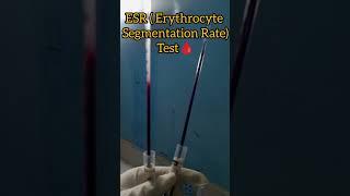 ESR (Erythrocyte Segmentation Rate)Test🩸#medicalstudent #medicalcollegestudents #science 